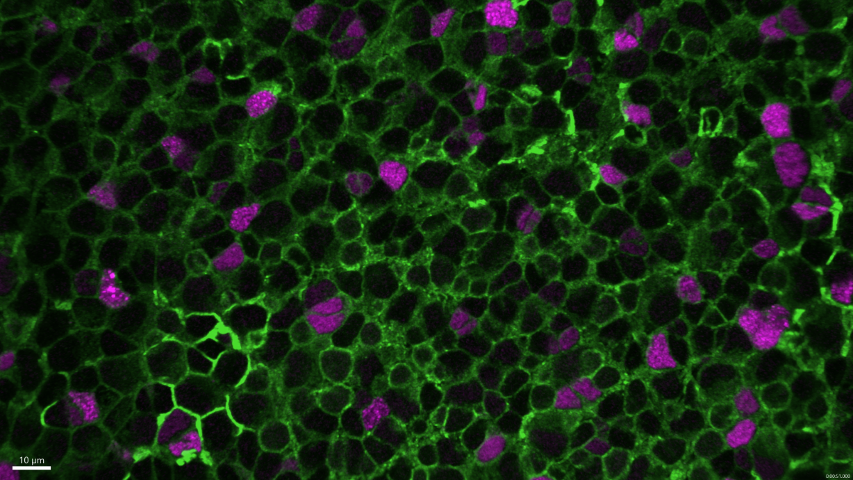 Cellules souches neurales © Institut Pasteur/Nicolas Dray, Laure Mancini, Laure Bally-Cuif Cellules souches neurales © Institut Pasteur/Nicolas Dray, Laure Mancini, Laure Bally-Cuif