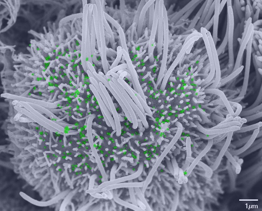 cellule ciliée infectée par le SARS-CoV-2 - Institut Pasteur