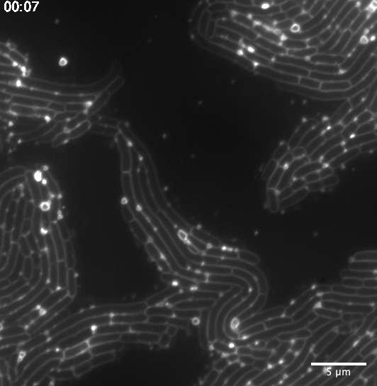 membrane vesicles