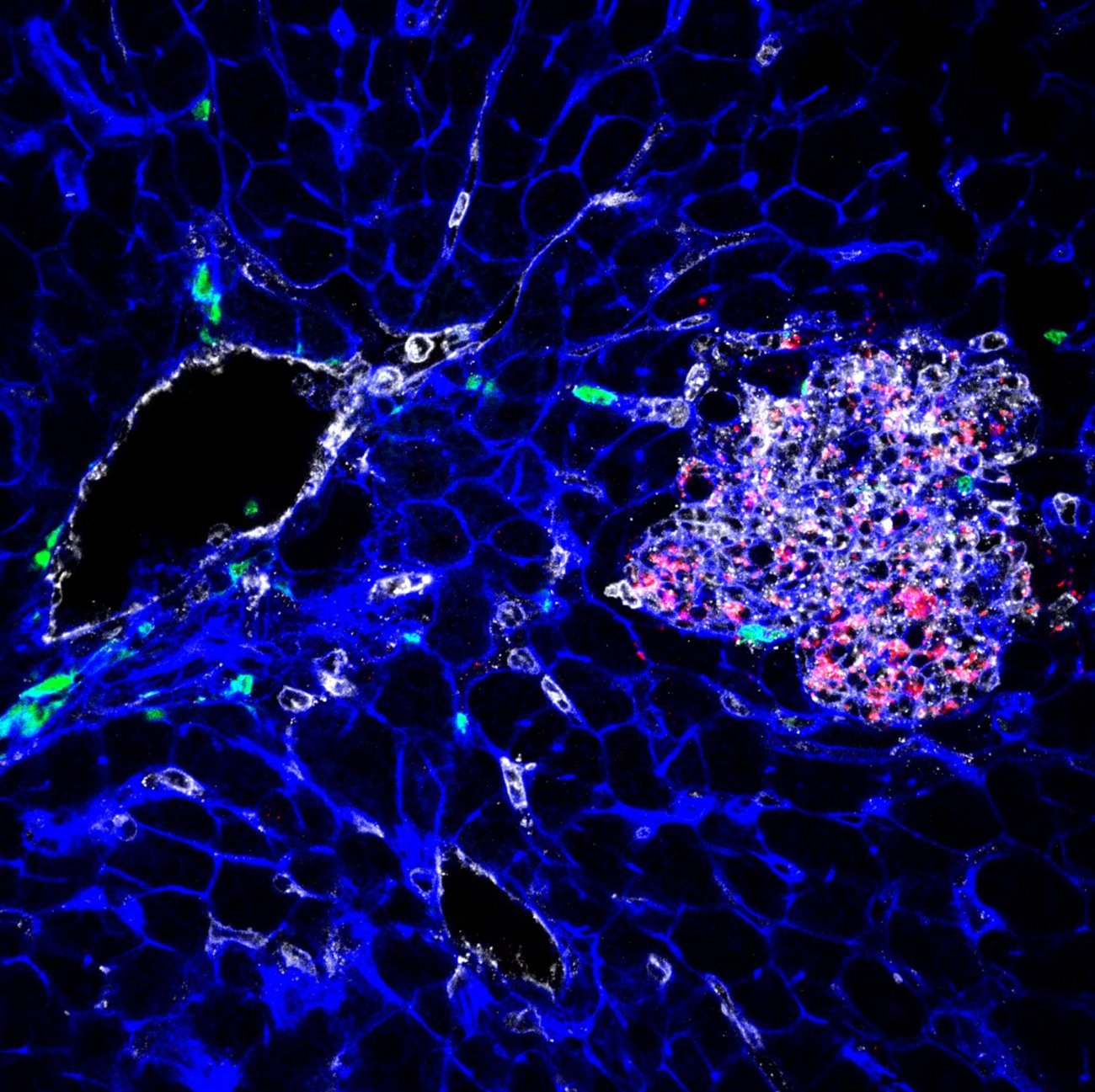Placenta infecté par Listeria monocytogenes (la bactérie apparaît en rouge) © Institut Pasteur Placenta infecté par Listeria monocytogenes (la bactérie apparaît en rouge) © Institut Pasteur