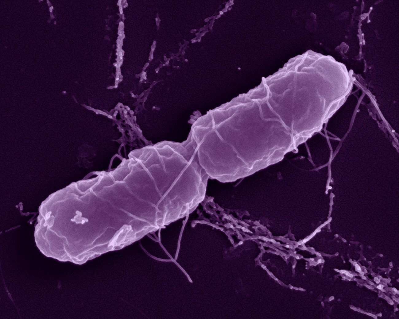 Bactérie Salmonella enterica en microscopie à balayage. © Institut Pasteur Bactérie Salmonella enterica en microscopie à balayage. © Institut Pasteur