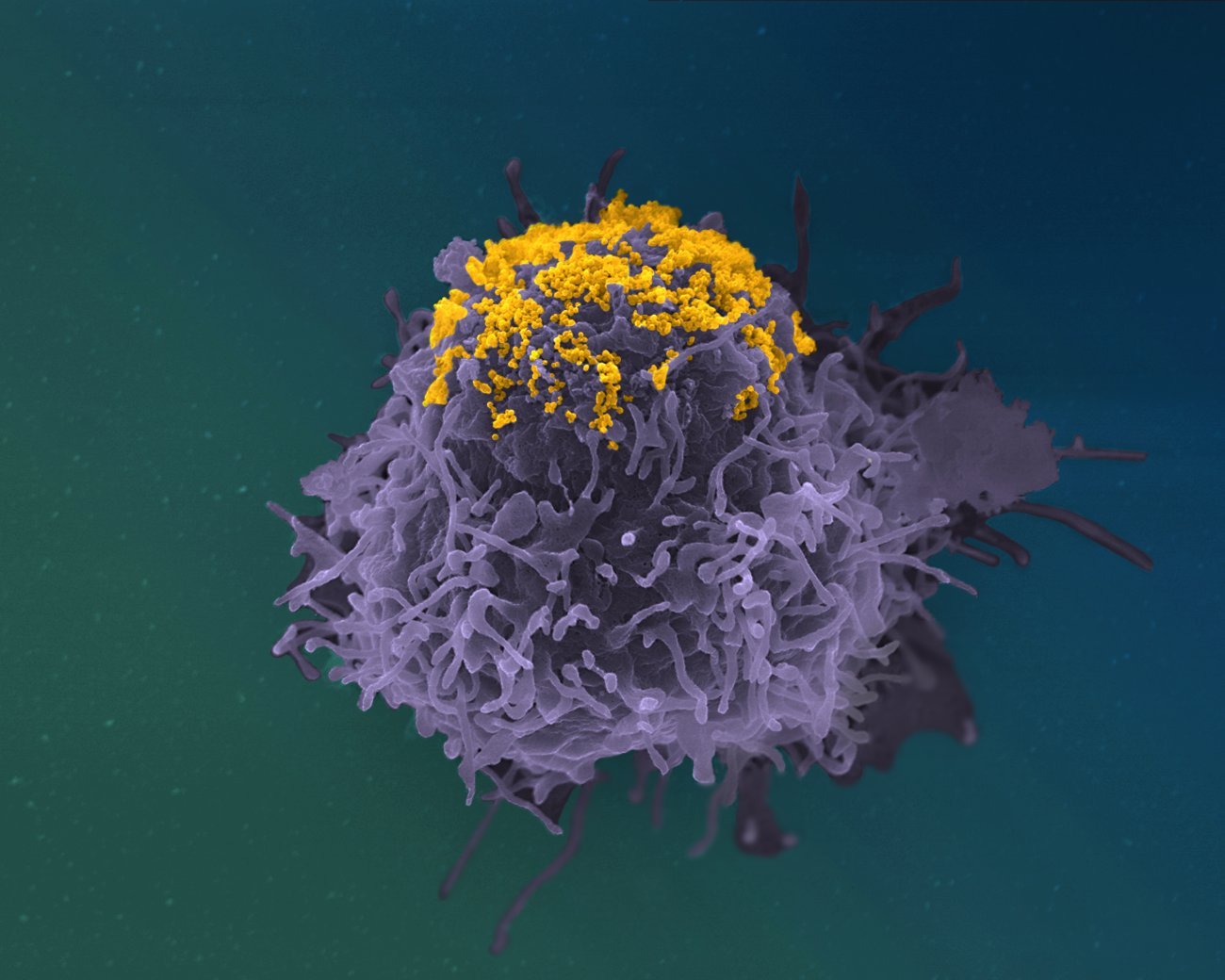 Accumulation de particules de VIH à la surface d’une cellule infectée - Institut Pasteur