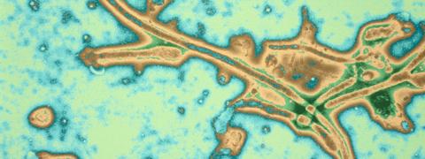 Virus Ebola, © Institut Pasteur