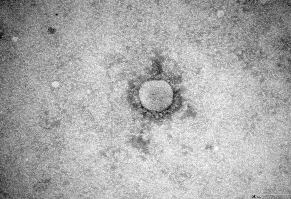 Le virus MERS-CoV au microscope électronique - © Institut Pasteur mers-cov_institut_pasteur.jpg