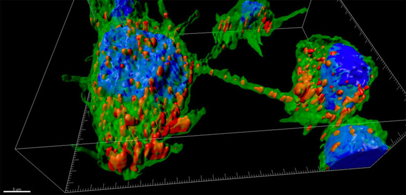 Des nanotubes permettent la diffusion de la maladie de Parkinson - Institut Pasteur Des nanotubes permettent la diffusion de la maladie de Parkinson - Institut Pasteur