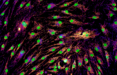 réseau mitochondrial © Timothy Wai / Institut Pasteur
