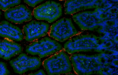 Cellules de l'intestin grêle murin et bactéries © Institut Pasteur/Gérard Eberl