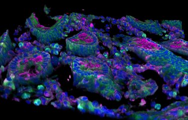 Cellules intestinales de singe vert d'Afrique © Institut Pasteur/Nicolas Huot