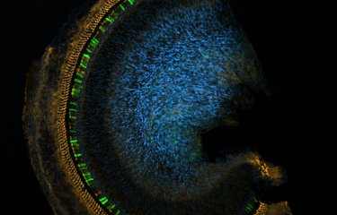 Partie de la spirale cochléaire © Audrey Maudoux/ Institut Pasteur