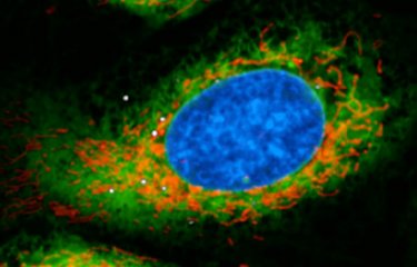 Legionellose : mécanisme inédit de régulation de la réponse immunitaire des cellules hôtes par la bactérie Legionella pneumophila