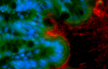 Un déséquilibre du microbiote intestinal favorise la survenue d’un cancer colorectal - Institut Pasteur