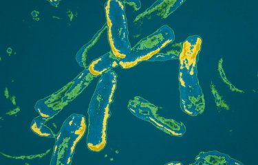 Pseudomonas aeruginosa, bactérie opportuniste, impliquée dans la mucoviscidose _ Institut Pasteur