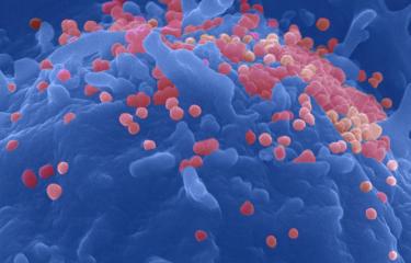 VIH : une fenêtre de vulnérabilité pour le renouvellement du réservoir viral après allogreffe de cellules souches