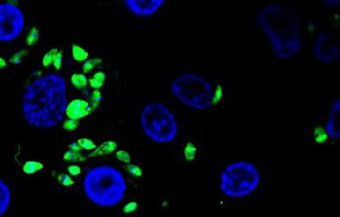 Leishmania : un parasite qui s’adapte à son environnement par amplification chromosomique - Institut Pasteur