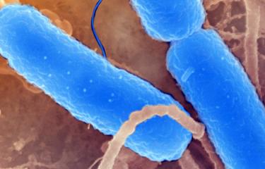 Dysenterie épidémique : enquête génomique sur l’exportation d’un fléau européen - Institut Pasteur