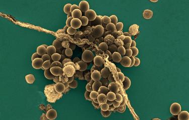 Staphylococcus aureus - Institut Pasteur