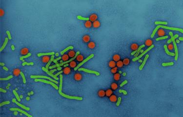 virus hépatite B - Institut Pasteur