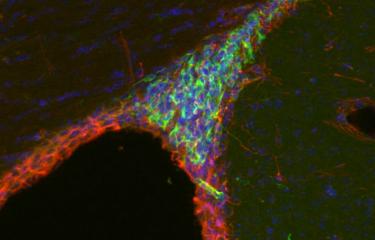 Stem cell neurons - Institut Pasteur