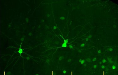 mouse frontal cortex copyright Institut Pasteur